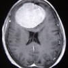 Neurosurgical Conditions - 